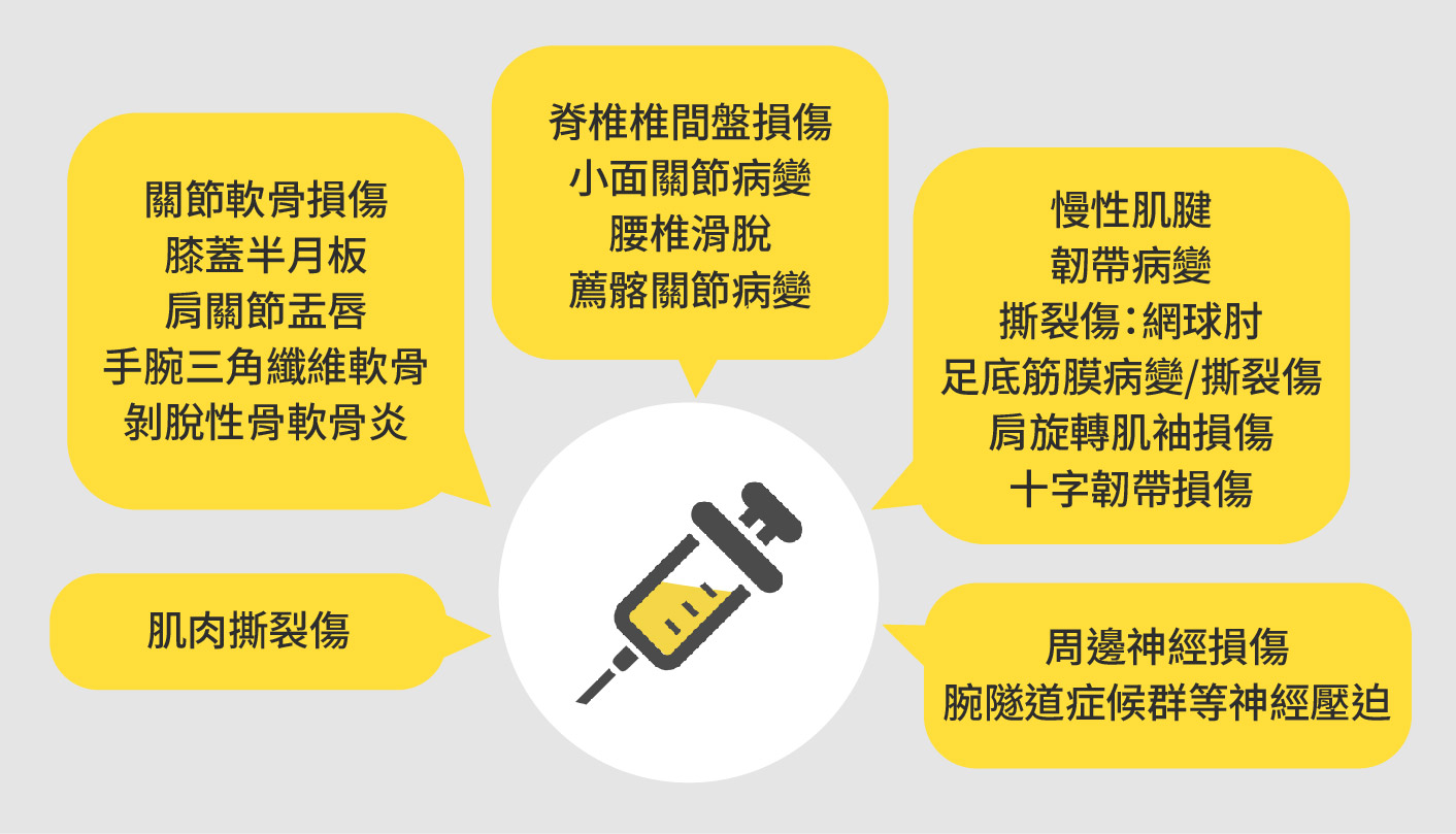 哪些人適合接受增生療法